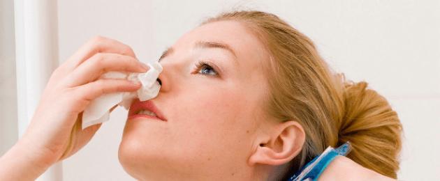 Частые кровотечения из носа. Причины носового кровотечения у взрослого. Терапия носовых кровотечений