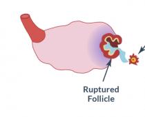 Необходимо знать сколько фолликулов должно быть в яичнике для зачатия